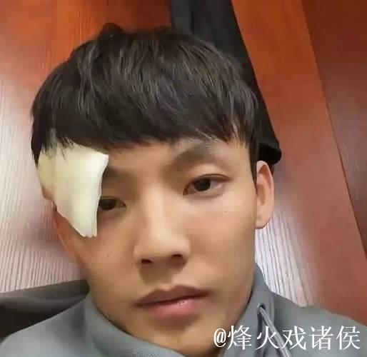 被邬挺嘉重伤后首发声,徐杰回应大格局,同曦队老总请吃饭赔罪 被邬挺嘉重伤后首发声,徐杰回应大格局,同曦队老总请吃饭赔罪